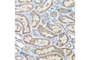 Immunohistochemistry of paraffin-embedded rat testis using NLRP1 Rabbit pAb (ABIN7268935) at dilution of 1:100 (40x lens). (NLRP1 抗体  (AA 1000-1100))
