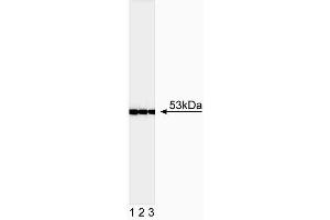 Western blot analysis of p53. (p53 抗体  (full length))