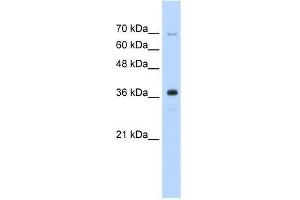 Human HepG2; WB Suggested Anti-ZRANB2 Antibody Titration: 0. (ZNF265 抗体  (Isoform 2, Middle Region))