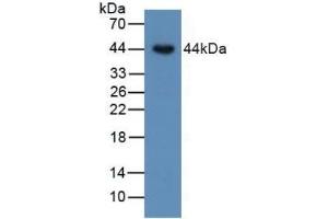 Detection of BMP15 in Human SKOV3 Cells using Polyclonal Antibody to Bone Morphogenetic Protein 15 (BMP15) (BMP15 抗体  (AA 266-388))