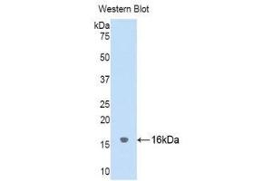 Western Blotting (WB) image for anti-Cystatin SA (CST2) (AA 21-141) antibody (ABIN1176748) (CST2 抗体  (AA 21-141))