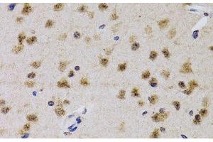 Immunohistochemistry of paraffin-embedded Mouse brain using CDK7 Polyclonal Antibody at dilution of 1:200 (40x lens). (CDK7 抗体)