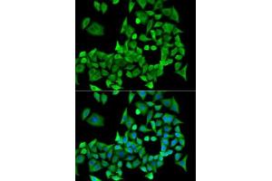 Immunofluorescence analysis of U2OS cells using PP2A-Aalpha/PR65α/PP2A-Aα/PR65α/PPP2R1A antibody (ABIN6132506, ABIN6146081, ABIN6146082 and ABIN6221483).