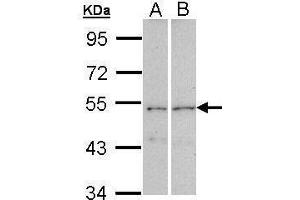WB Image Sample (30 ug of whole cell lysate) A: A431 , B: Raji 7. (CPEB1 抗体  (C-Term))