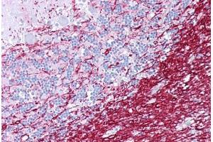 Anti-PLP1 antibody IHC staining of human brain, cerebellum. (PLP1 抗体  (AA 36-85))