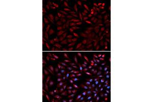 Immunofluorescence (IF) image for anti-Proteasome (Prosome, Macropain) 26S Subunit, ATPase, 2 (PSMC2) (AA 1-160) antibody (ABIN3015801)