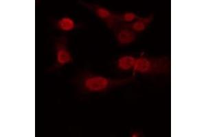 ABIN6266935 staining Hela by IF/ICC. (T-Box 22 抗体  (N-Term))
