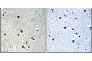 Immunohistochemistry analysis of paraffin-embedded human brain tissue, using HDAC5 (Ab-259) Antibody. (HDAC5 抗体  (AA 225-274))