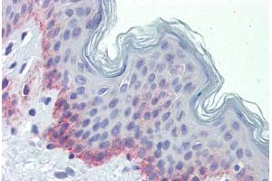 Human Skin (formalin-fixed, paraffin-embedded) stained with PNPT1 antibody ABIN462230 followed by biotinylated goat anti-rabbit IgG secondary antibody ABIN481713, alkaline phosphatase-streptavidin and chromogen. (PNPT1 抗体  (AA 489-538))