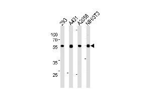 Lane 1: 293 Cell lysates, Lane 2: A431 Cell lysates, Lane 3: A2058 Cell lysates, Lane 4: NIH/3T3 Cell lysates, probed with TPIPb (978CT6. (TPTE2 抗体)