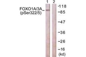 Western blot analysis of extracts from NIH-3T3 cells treated with Wortmannin 40nM 24h, using FOXO1A/3A (Phospho-Ser322+Ser325) Antibody. (FOXO1A/3A (AA 291-340), (pSer322) 抗体)