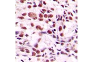 Immunohistochemistry (IHC) image for anti-Cleavage Stimulation Factor, 3' Pre-RNA, Subunit 2, 64kDa (CSTF2) (N-Term) antibody (ABIN7295396)