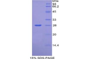SDS-PAGE analysis of Rat CREB Binding Protein. (CBP 蛋白)