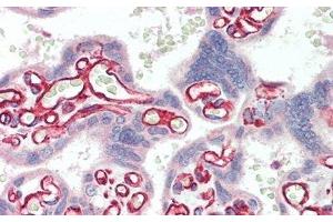 Immunohistochemistry (IHC) image for anti-Sulfatase 2 (SULF2) (AA 337-654) antibody (ABIN7441439)