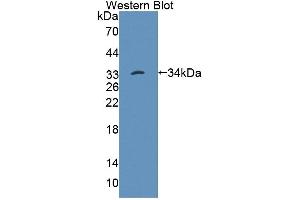 Western Blotting (WB) image for anti-Tyrosine-Protein Phosphatase Non-Receptor Type 22 (PTPN22) (AA 1-256) antibody (ABIN5014223)