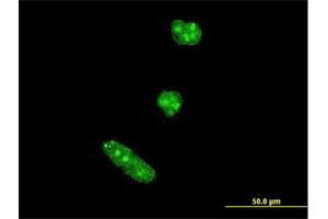 Immunofluorescence of monoclonal antibody to TWIST1 on HeLa cell. (TWIST1 抗体  (AA 100-202))