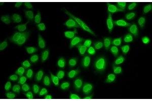 Immunofluorescence analysis of MCF-7 cells using RANGAP1 Polyclonal Antibody (RANGAP1 抗体)