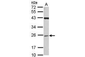Image no. 1 for anti-Ubiquitin-Conjugating Enzyme E2F (UBE2F) (AA 1-185) antibody (ABIN1501629) (UBE2F 抗体  (AA 1-185))
