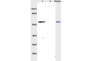 L1 rat brain lysates L2 rat kidney lysates probed with Anti CSIG Polyclonal Antibody, Unconjugated (ABIN728248) at 1:200 overnight at 4 °C. (RSL1D1 抗体  (AA 151-250))