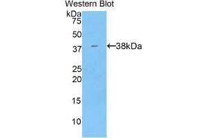 Detection of Recombinant KRT71, Mouse using Polyclonal Antibody to Keratin 71 (KRT71) (Keratin 71 抗体  (AA 132-440))