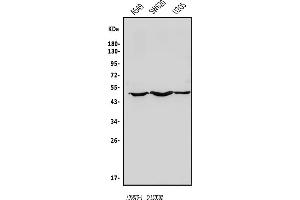 Western blot analysis of NDP52/CALCOCO2 using anti-NDP52/CALCOCO2 antibody (ABIN7599401).
