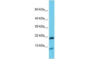 Host: Rabbit Target Name: Grem1 Sample Type: Rat Testis lysates Antibody Dilution: 1. (GREM1 抗体  (Middle Region))