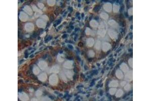 IHC-P analysis of Human Tissue, with DAB staining. (CRADD 抗体  (AA 1-199))