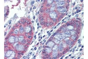 Human Colon: Formalin-Fixed, Paraffin-Embedded (FFPE) (METTL7B 抗体  (C-Term))
