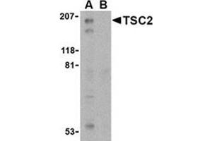 Western blot analysis of TSC2 in L1210 cell lysate with this product at 1 μg/ml in the (A) absence and (B) presence of blocking peptide.