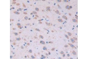 Used in DAB staining on fromalin fixed paraffin- embedded Kidney tissue (FGF22 抗体  (AA 26-162))