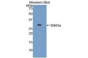 Detection of Recombinant FGA, Mouse using Polyclonal Antibody to Fibrinogen Alpha Chain (FGA) (FGA 抗体  (AA 34-255))