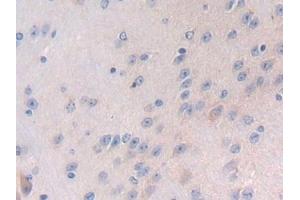 Detection of LTBP1 in Mouse Cerebrum Tissue using Polyclonal Antibody to Latent Transforming Growth Factor Beta Binding Protein 1 (LTBP1)