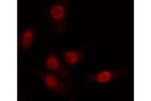 ABIN6274263 staining 293 cells by IF/ICC. (CDK8 抗体  (N-Term))