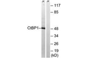 Western blot analysis of extracts from Jurkat cells, using CtBP1 (Ab-422) Antibody. (CTBP1 抗体  (AA 388-437))