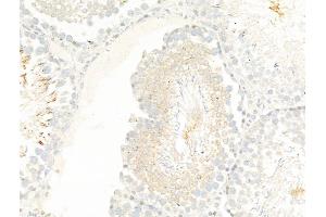 ABIN7094884 and ABIN7098937 at 1/100 staining Rat testis tissue by IHC-P. (TTC7A 抗体  (Internal Region))