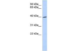 WB Suggested Anti-TRIB1 Antibody Titration: 0. (TRIB1 抗体  (Middle Region))
