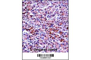 PRSS2 Antibody immunohistochemistry analysis in formalin fixed and paraffin embedded human pancreas tissue followed by peroxidase conjugation of the secondary antibody and DAB staining. (PRSS2 抗体  (AA 80-108))