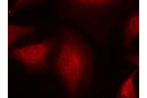 Immunofluorescence staining of methanol-fixed HeLa cells using MDM2 polyclonal antibody (Cat # PAB12253, Red). (MDM2 抗体  (Ser166))