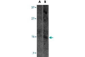 Western blot analysis of UCMA in SW1353 cell lysate with UCMA polyclonal antibody  at (A) 2. (UCMA 抗体  (C-Term))