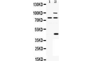 Observed bind size: 80KD, 45/80/100KD (PCSK6 抗体  (C-Term))