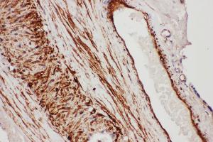 Anti- TFPI antibody, IHC(P) IHC(P): Human Placenta Tissue (TFPI 抗体  (N-Term))