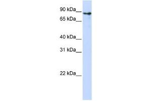 Western Blotting (WB) image for anti-Kelch-Like 1 (KLHL1) antibody (ABIN2458401) (KLHL1 抗体)