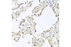 Immunohistochemistry of paraffin-embedded human lung using MMRN1 antibody. (Multimerin 1 抗体)