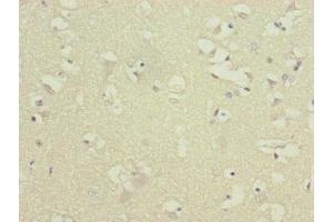 Immunohistochemistry of paraffin-embedded human brain tissue using ABIN7144847 at dilution of 1:100 (ATP5F1D 抗体  (AA 1-168))