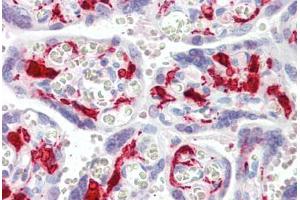 Human Placenta (formalin-fixed, paraffin-embedded) stained with F13A1 antibody ABIN461969 at 5 ug/ml followed by biotinylated secondary antibody, alkaline phosphatase-streptavidin and chromogen. (F13A1 抗体)