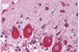 Human Brain, Cerebellum (formalin-fixed, paraffin-embedded) stained with NUCB1 antibody ABIN214130 at 5 ug/ml followed by biotinylated goat anti-rabbit IgG secondary antibody ABIN481713, alkaline phosphatase-streptavidin and chromogen. (Nucleobindin 1 抗体  (C-Term))