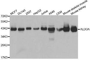 Western blot analysis of extracts of various cell lines, using ALDOA antibody. (ALDOA 抗体  (AA 1-348))