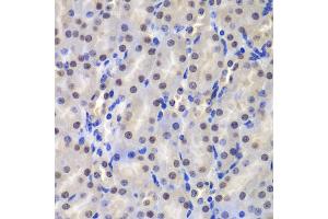 Immunohistochemistry of paraffin-embedded mouse kidney using GSTP1 antibody (ABIN5973328) at dilution of 1/200 (40x lens). (GSTP1 抗体)