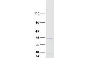 Validation with Western Blot