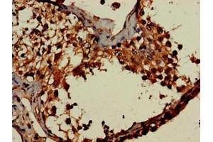 Immunohistochemistry of paraffin-embedded human testis tissue using ABIN7155530 at dilution of 1:100 (DOT1L 抗体  (AA 331-484))